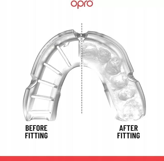 Opro Burnos apsauga vaikams Silver Skaidri