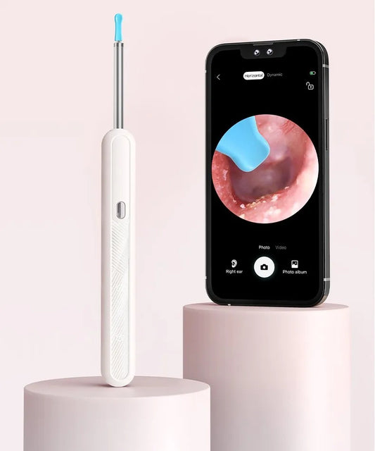 Išmanusis otoskopas ausų valymui su 8MP WiFi kamera, skirta Android ir iOS