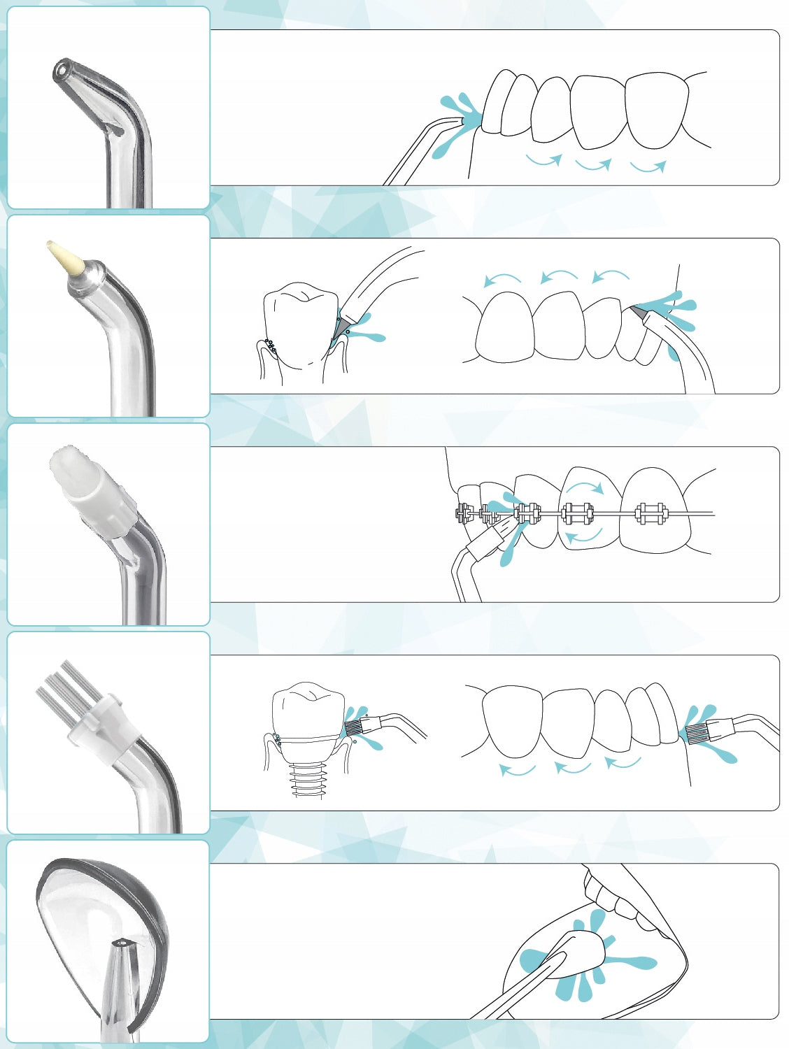Belaidis nešiojamasis irigatorius, dantų priežiūros priemonė, 5 režimai + dėklas