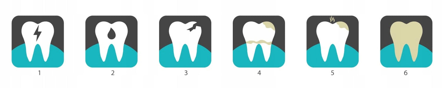 Belaidis nešiojamasis irigatorius, dantų priežiūros priemonė, 5 režimai + dėklas