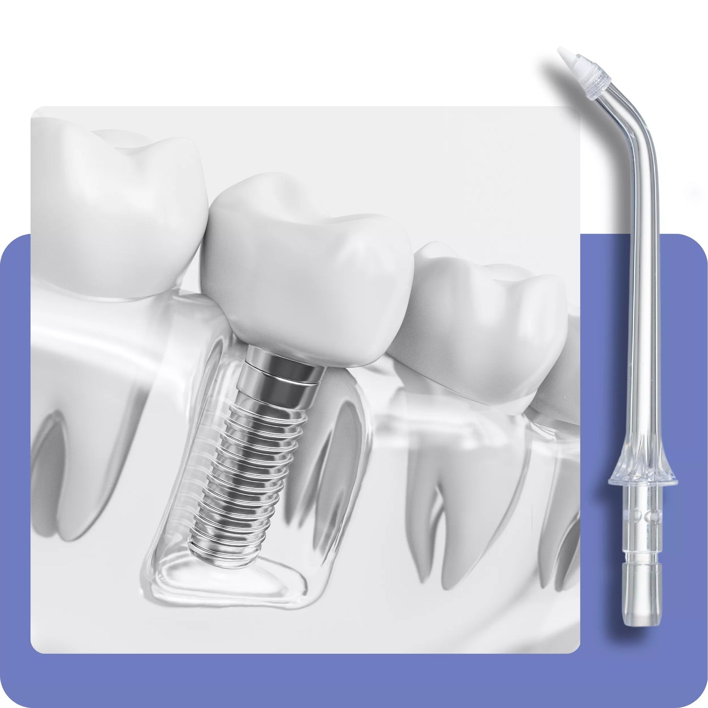 Belaidis dantų irigatorius burnos higienai DentalForce 400ml