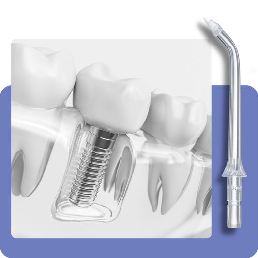 Belaidis dantų irigatorius burnos higienai DentalForce 400ml