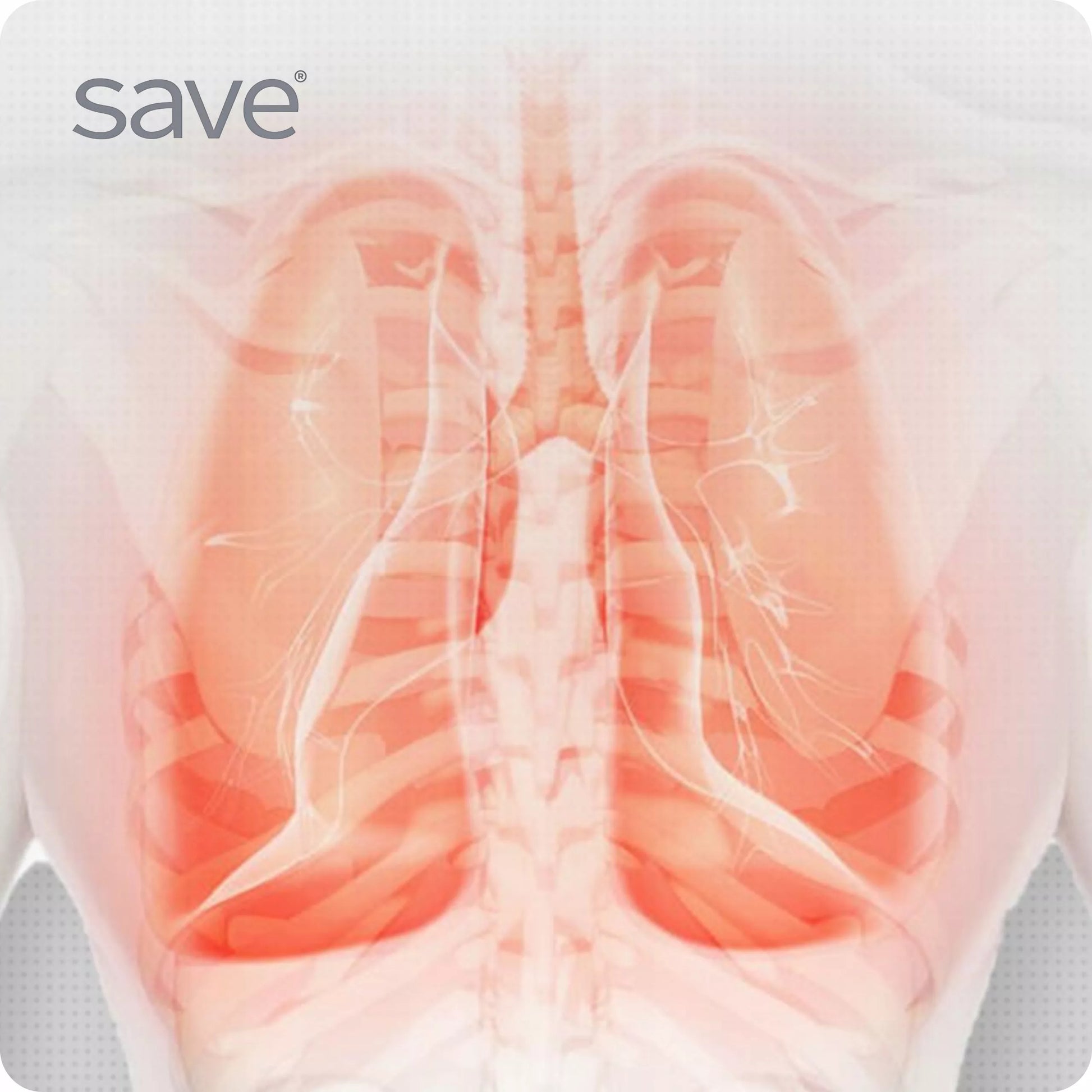 PRZENOŚNY NEBULIZATOR SIATECZKOWY CICHY DLA DZIECI I DOROSŁYCH SAVE