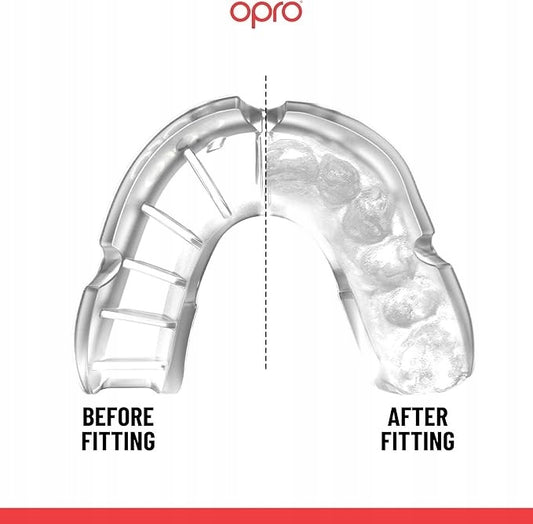 Opro Burnos apsauga vaikams Silver Skaidri