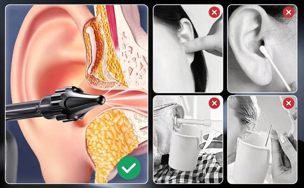 Ausų sieros šalinimo irigatorius, ausų valymo prietaisas, 5 režimai, 10 antgalių, USB-C
