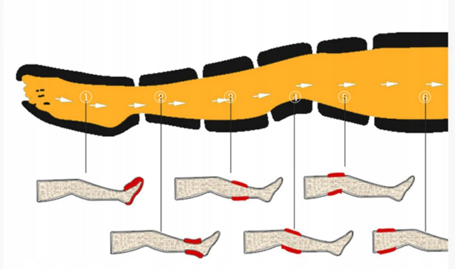 Presoterapija limfos drenažas kojų masažuoklis masažas