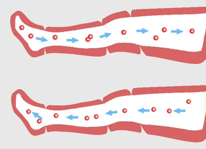 Presoterapija limfos drenažas kojų masažuoklis masažas