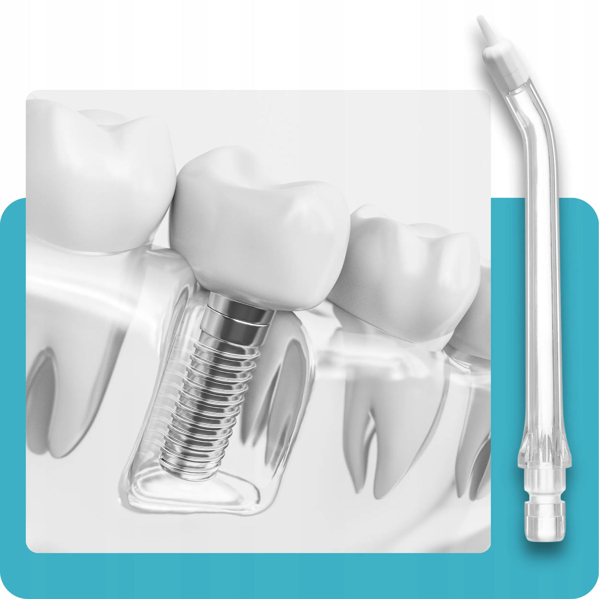 Belaidis „DentalForce“ burnos irigatorius, 310 ml